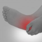 足の裏が痛い！ランナーに多い足底筋膜炎の治し方と予防策